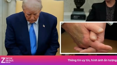 Bàn tay của ông Trump bất ngờ thu hút sự chú ý