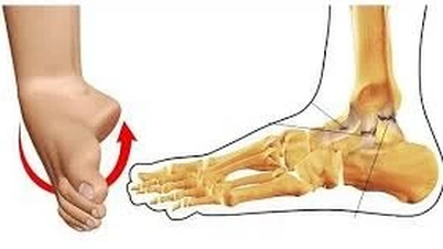 Mẻ xương do bị ngã phải làm sao?