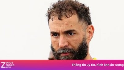 Diện mạo khác lạ của Benzema