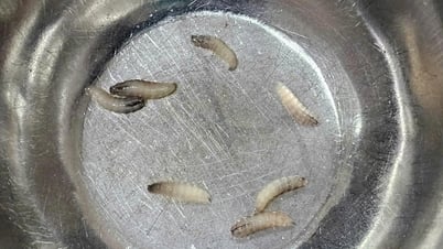 Bác sĩ gắp 7 con dòi từ mũi người phụ nữ 60 tuổi