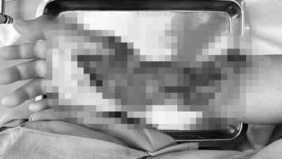 Кирпичная стена внезапно рухнула, 10-летний ребенок получил серьезные травмы