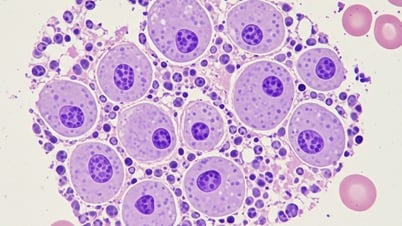 Nghiên cứu mới: Loại virus mới giúp điều trị ung thư chỉ sau 28 ngày