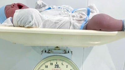 Sinh mổ thành công bé trai gần 6 kg tại Bệnh viện Đa khoa Trần Văn Thời