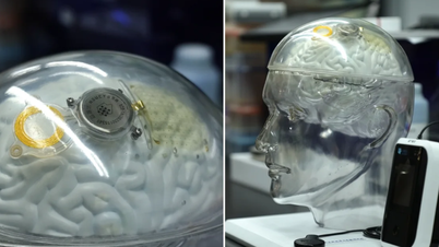Trung Quốc đuổi sát Mỹ trong công nghệ não bộ, sánh ngang Neuralink