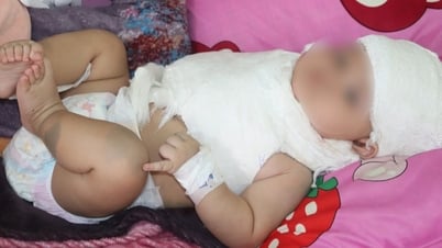Căn bệnh "hiểm" do sang chấn sản khoa, khiến cháu bé vừa sinh đã liệt tay