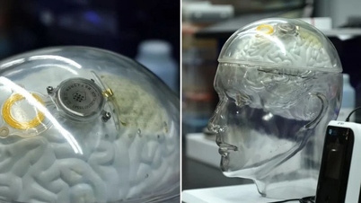 Neuralink lần đầu cấy chip cho 2 bệnh nhân trong ngày
