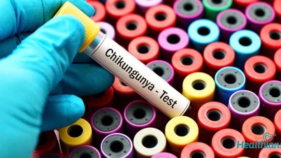 WHO cảnh báo nguy cơ lây lan cao của virus Chikungunya