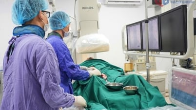 Can thiệp mạch máu não: Chìa khóa vàng trong điều trị đột quỵ