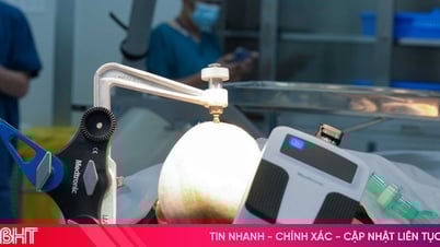 Robot AutoGuide lần đầu xuất hiện tại Việt Nam: Bước ngoặt công nghệ trong điều trị động kinh
