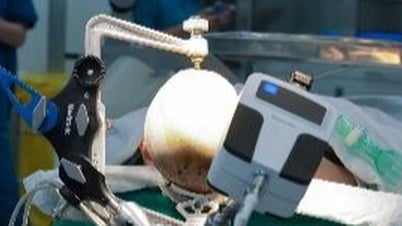 Bé gái 9 tuổi thoát cảnh co giật chục lần mỗi ngày nhờ kỹ thuật đặc biệt