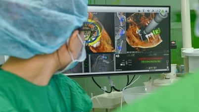 Ứng dụng 'GPS nha khoa' X-Guide: Bước tiến mới trong cấy ghép Implant