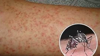 Tăng cường công tác phòng, chống bệnh sốt xuất huyết