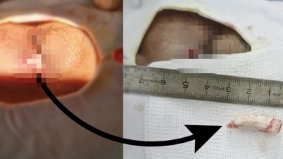 Người đàn ông suýt mù vì bị... gà trống nhảy lên đá vào mặt