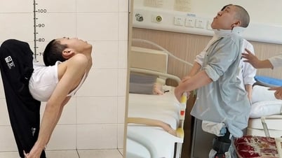 The turning point of a male student with severe spinal deformity