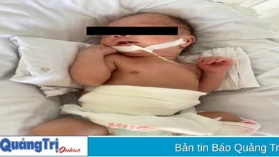 Successfully saved the life of a 35-week-old patient with a perforated stomach