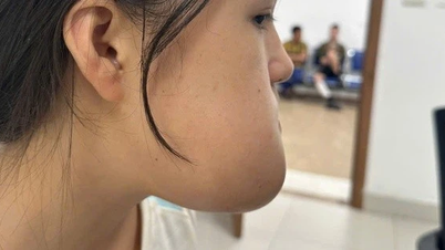 Phẫu thuật loại bỏ khối u, lấy lại thẩm mỹ khuôn mặt cho cô gái 16 tuổi