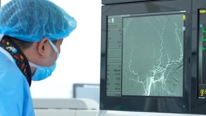 Bóc trọn khối u não 6 cm, bệnh nhân hồi phục sau 2 giờ phẫu thuật