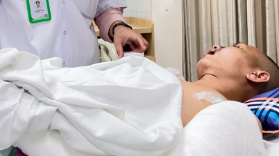 Vỡ gan, đa chấn thương sau tai nạn giao thông nghiêm trọng