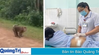Xã Cam Lộ: Khỉ tấn công khiến cháu bé 10 tuổi nhập viện