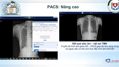 Chậm nhất ngày 30/9, các bệnh viện phải triển khai bệnh án điện tử