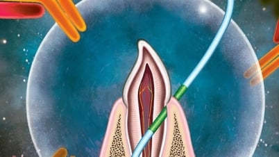 Một loại vaccine mới không cần kim tiêm, có tác dụng như chỉ nha khoa, cần nghiên cứu thêm