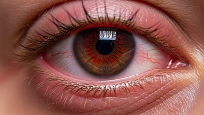 3 biểu hiện ở mắt cảnh báo vấn đề về thận