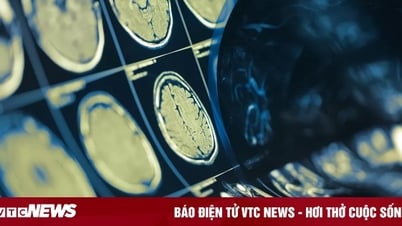 Công nghệ 17/8: Chip não giải mã suy nghĩ con người với độ chính xác 74% 