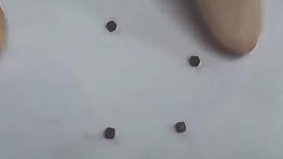 Bé trai 6 tuổi thủng ruột do nuốt 4 cục nam châm