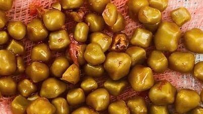 Mổ cấp cứu nữ bệnh nhân có hơn 100 viên sỏi chứa đầy trong túi mật