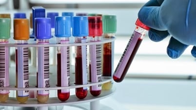 Tại sao người gầy, ít ăn dầu mỡ nhưng mỡ máu vẫn cao?