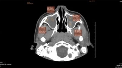 Ear, nose and throat diseases in children can cause dangerous complications.