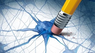 Khám phá hợp chất tự nhiên có khả năng loại bỏ protein gây bệnh Alzheimer