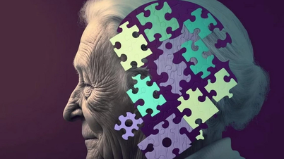 Nguyên tố Lithium mở hy vọng mới cho điều trị bệnh Alzheimer
