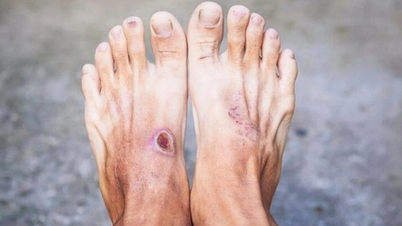 Bước đột phá mới trong điều trị bệnh tiểu đường tuýp 1