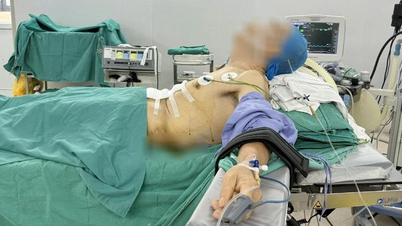Ca phẫu thuật đặc biệt cho bệnh nhân ung thư dạ dày lại gù vẹo cột sống nặng