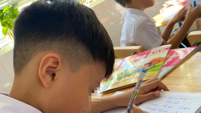 Tiếp sức trẻ tự kỷ