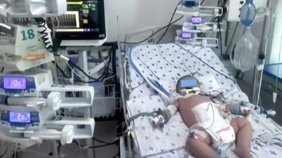 Căn bệnh dễ chẩn đoán nhầm khiến bé 7 tháng tuổi nôn ra dịch đen
