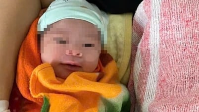 Hy hữu, bé trai sơ sinh chào đời với dây rốn quấn 6 vòng quanh cổ
