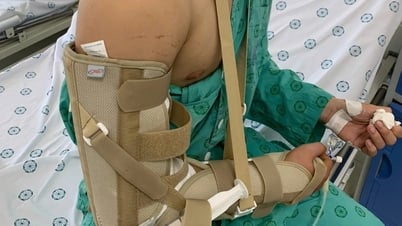 Chơi vật tay, chàng trai Hà Nội gãy xương