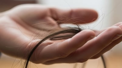 Rụng tóc từng mảng có mọc lại được không?