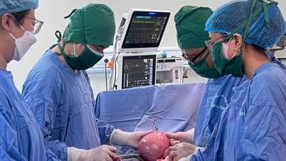 Woman carries 3kg uterine fibroid, equivalent to a fetus