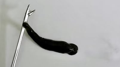 Đỉa suối 4cm nằm trong mũi một thiếu niên