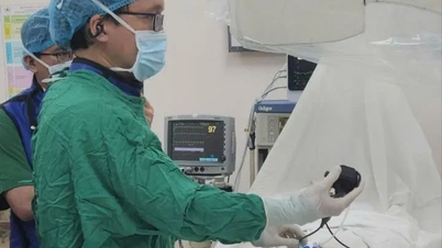 Bệnh viện Nhân dân 115 lần đầu tán sỏi túi mật xuyên gan qua da