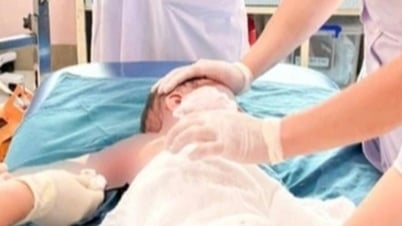 Hà Nội: 3 trẻ trong một gia đình bị bỏng do lật nồi lẩu