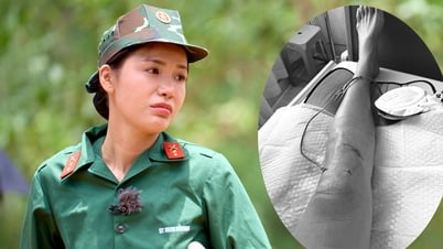 슈퍼모델 민투, 중상…의사 경고