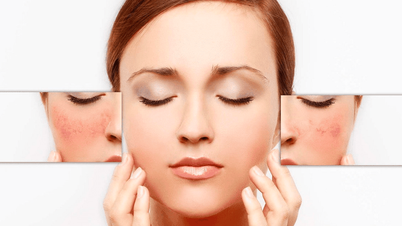 Why is skin easily unbalanced when the weather changes constantly?
