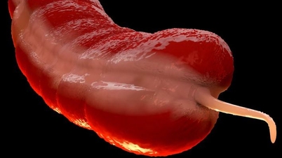 A forgotten cancer on the rise in young people has experts baffled