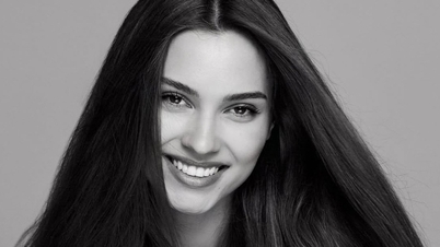 Cantik Rusia tiba-tiba meninggal dunia pada usia 31 tahun