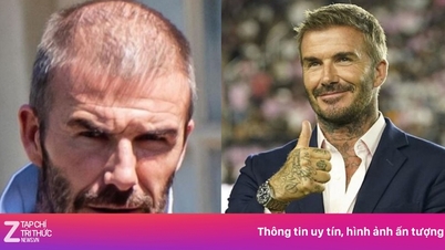 Fotbollsstjärnor "går under kniven" för att förändra sitt utseende