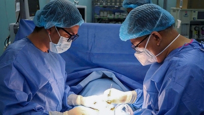 Tại sao giãn tĩnh mạch tinh thường ở bên trái?